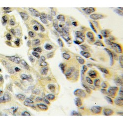 Protein Tyrosine Phosphatase Receptor Type S (PTPRS) Antibody