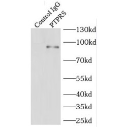 Protein Tyrosine Phosphatase Receptor Type S (PTPRS) Antibody