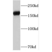 abx236949