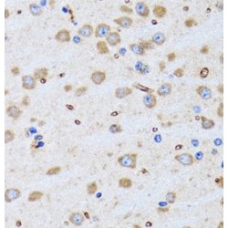 Peptidyl-tRNA Hydrolase 2 (PTRH2) Antibody