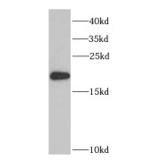 WB analysis of HEK-293 cells, using PTRH2 antibody (1/1000 dilution).