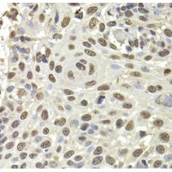 Poly(U) Binding Splicing Factor 60 (PUF60) Antibody