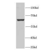 WB analysis of HeLa cells, using PUF60 antibody (1/1000 dilution).