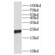WB analysis of rat liver tissue, using PXMP2 antibody (1/600 dilution).