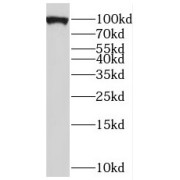 WB analysis of human brain tissue, using PYGB antibody (1/500 dilution).