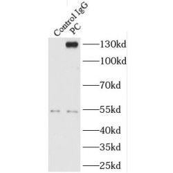 Pyruvate Carboxylase Antibody