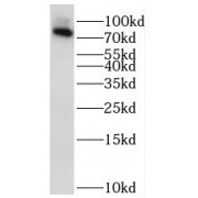 WB analysis of mouse brain tissue, using RAB11FIP3 antibody (1/600 dilution).