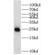 WB analysis of MCF-7 cells, using20229-1-AP (RAB11A-Specific antibody (1/1000 dilution).