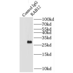 RAB12, Member RAS Oncogene Family (RAB12) Antibody