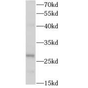 WB analysis of HeLa cells, using RAB12 antibody (1/500 dilution).