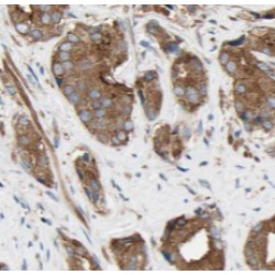 RAB18, Member RAS Oncogene Family (Rab18) Antibody