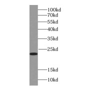 WB analysis of human adrenal gland tissue, using RAB18 antibody (1/1000 dilution).