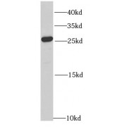 WB analysis of HL-60 cells, using RAB27A antibody (1/1000 dilution).