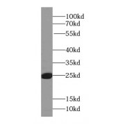 WB analysis of HL-60 cells, using RAB27A-specific antibody (1/600 dilution).
