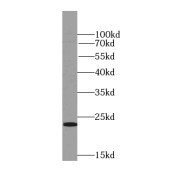 WB analysis of human brain tissue, using RAB31-specific antibody (1/500 dilution).