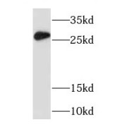 abx237017