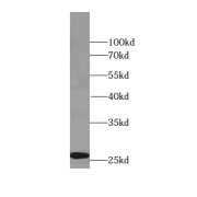 WB analysis of human brain tissue, using RAB3C-specific antibody (1/300 dilution).