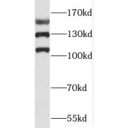 WB analysis of mouse brain tissue, using RAB3GAP2 antibody (1/600 dilution).