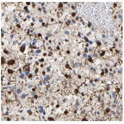 RAB5A, Member RAS Oncogene Family (RAB5A) Antibody