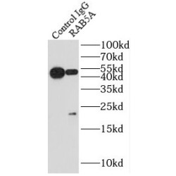 RAB5A, Member RAS Oncogene Family (RAB5A) Antibody