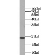 WB analysis of mouse brain tissue, using RAB5A antibody (1/500 dilution).