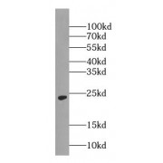 WB analysis of human brain tissue, using RAB5A-Specific antibody (1/500 dilution).
