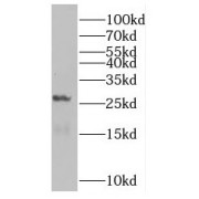 WB analysis of mouse lung tissue, using RAB5B antibody (1/1000 dilution).