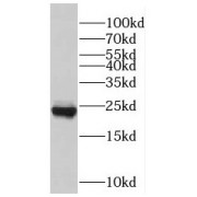 WB analysis of SH-SY5Y cells, using RAB7A antibody (1/800 dilution).