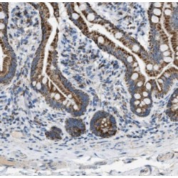 RAB7B, Member RAS Oncogene Family (RAB7B) Antibody