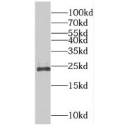 WB analysis of HepG2 cells, using RAB9B antibody (1/300 dilution).