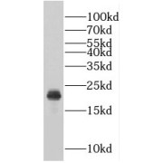 WB analysis of HEK-293 cells, using RABAC1 antibody (1/500 dilution).