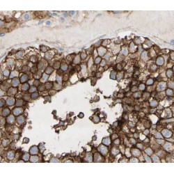 Rabenosyn-5 (RBSN) Antibody