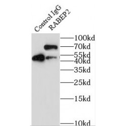Rabaptin, RAB GTPase Binding Effector Protein 2 (RABEP2) Antibody