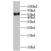 WB analysis of Jurkat cells, using RABEP2 antibody (1/1000 dilution).