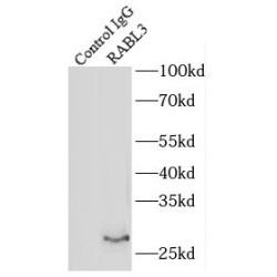 RAB, Member of RAS Oncogene Family Like 3 (RABL3) Antibody
