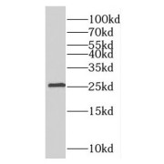 WB analysis of human lung tissue, using RABL3 antibody (1/300 dilution).