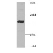 WB analysis of HL-60 cells, using RAC2 antibody (1/1000 dilution).