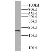 WB analysis of HL-60 cells, using RAC2 antibody (1/600 dilution).