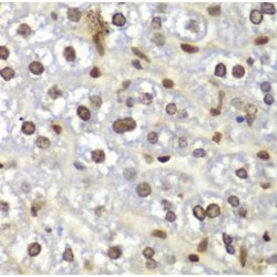 Receptor For Activated C Kinase 1 (RACK1) Antibody