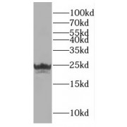 WB analysis of COLO 320 cells, using Rad51D antibody (1/1000 dilution).