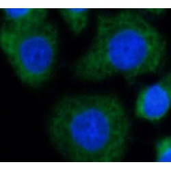 Radixin (RDX) Antibody
