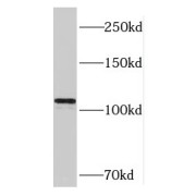 WB analysis of HeLa cells, using RAI14 antibody (1/400 dilution).