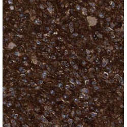 Rap1 GTPase-GDP Dissociation Stimulator 1 (RAP1GDS1) Antibody