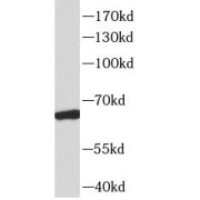 WB analysis of mouse brain tissue, using RAP1GDS1 antibody (1/600 dilution).