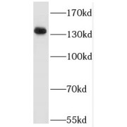 WB analysis of HepG2 cells, using Raptor antibody (1/1000 dilution).