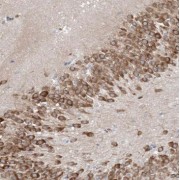 IHC-P analysis of human brain tissue, using RARB antibody (1/50 dilution).