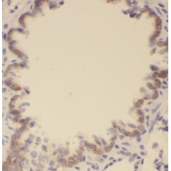 Phospholipase A and Acyltransferase 4 / RARRES3 (PLAAT4) Antibody