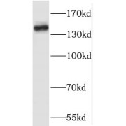 WB analysis of HeLa cells, using RASAL2 antibody (1/2000 dilution).
