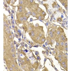 Ras-Specific Guanine Nucleotide-Releasing Factor 1 (RASGRF1) Antibody
