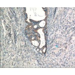 Ras Guanyl-Releasing Protein 3 (RASGRP3) Antibody